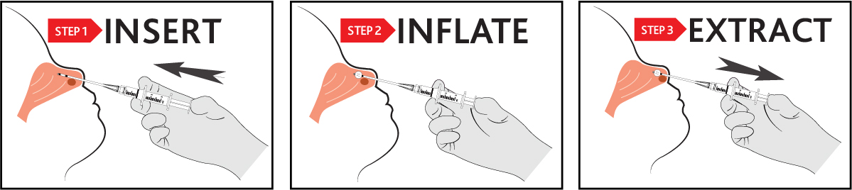 Simple 3-step process for extraction